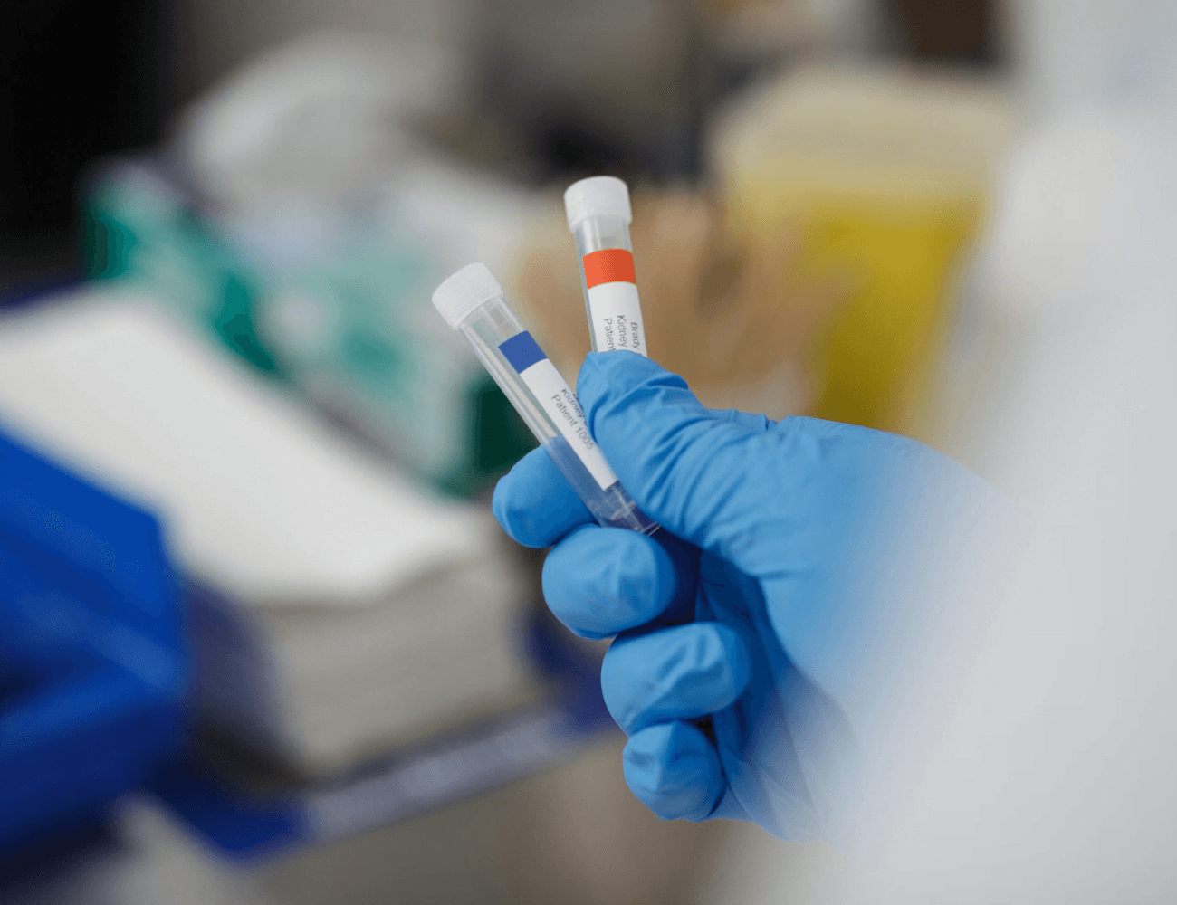 Laboratorinių mėginių ir pavyzdžių žymėjimas Laboratoriniu meginiu ir pavyzdziu zymejimas etiketemis